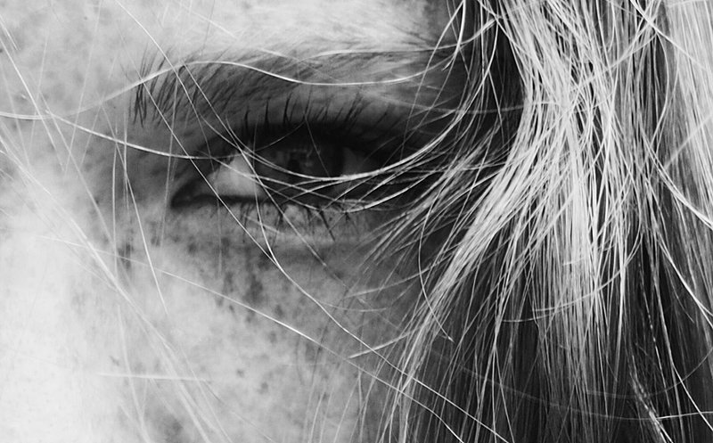 Die schönsten Punkte der Welt: Sommersprossen