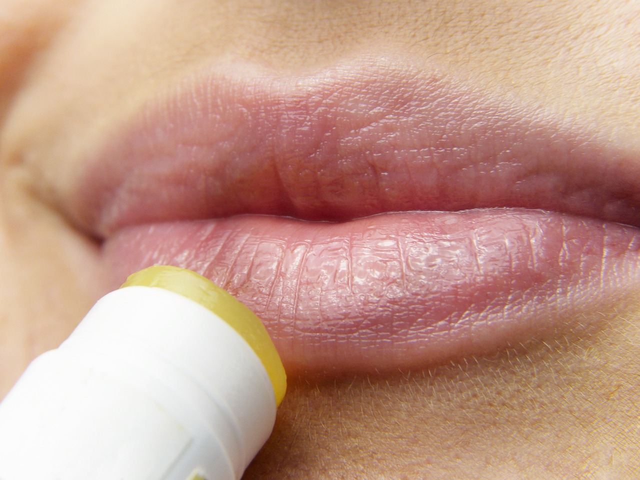 Why is lip care with sun protection factor a must in summer?